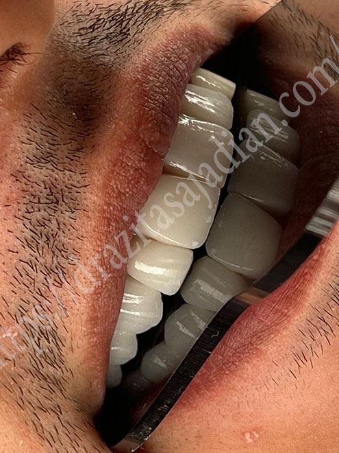 مطب دندانپزشکی نازی آباد